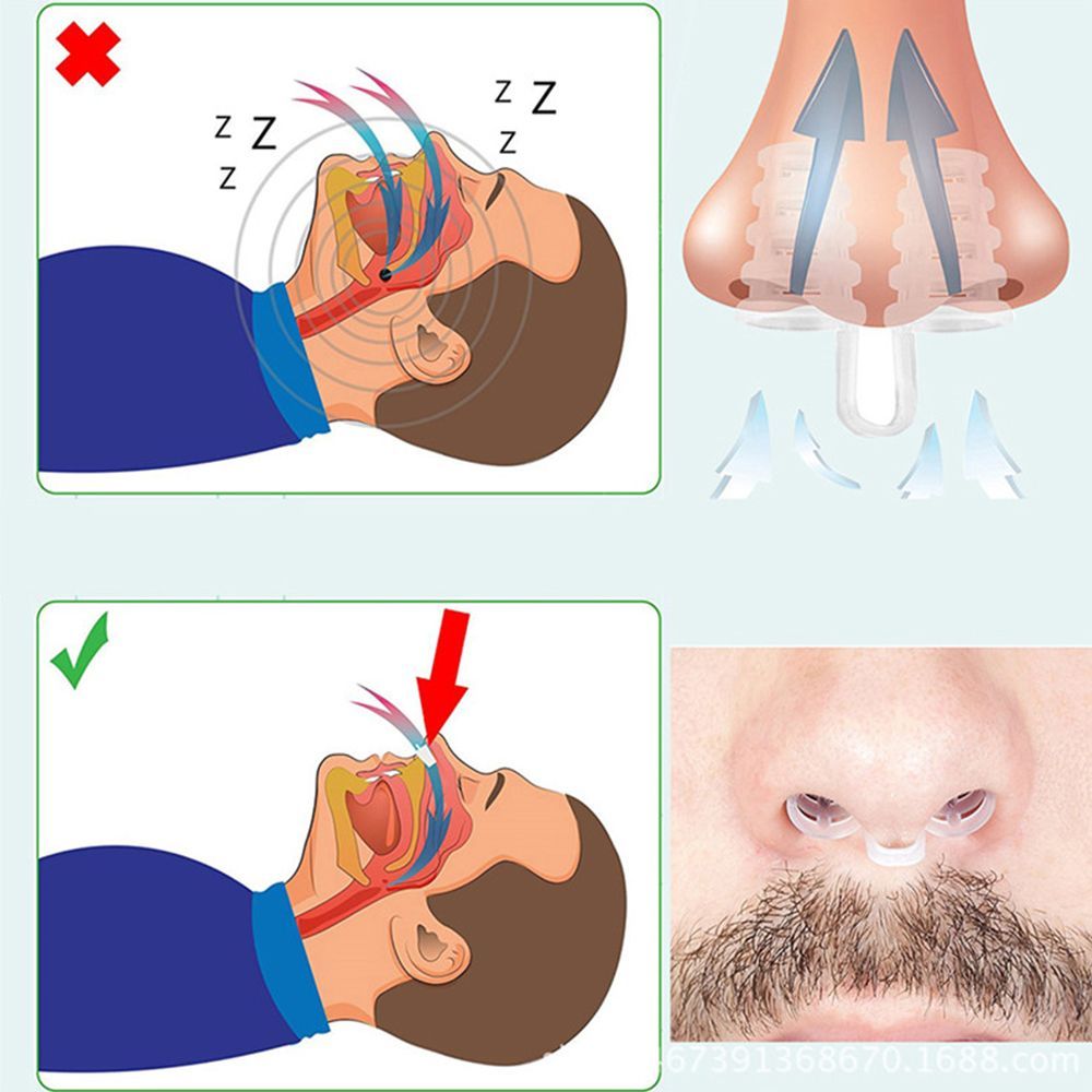 Anti Snore Nose Clip Set, Comfortable Nasal Dilators for Snoring & Sleep Apnea Relief