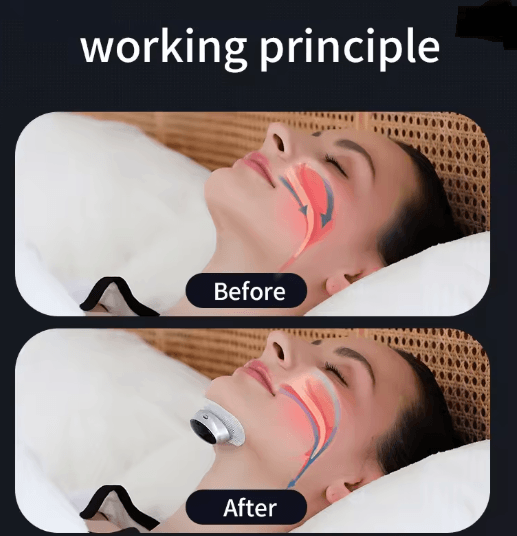 Smart Anti Snoring Device Easy Breathe Sleep Aid with EMS Support
