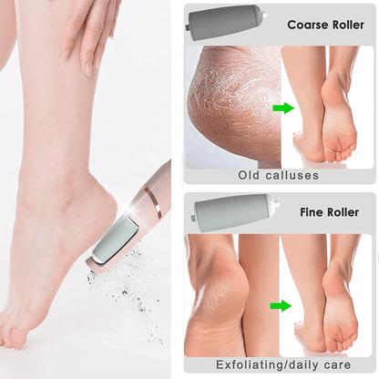 Professional Electric Pedicure Tool Film Foot Dead Skin Callus Remover Feet Exfoliator Pumice Stone Device for Heels