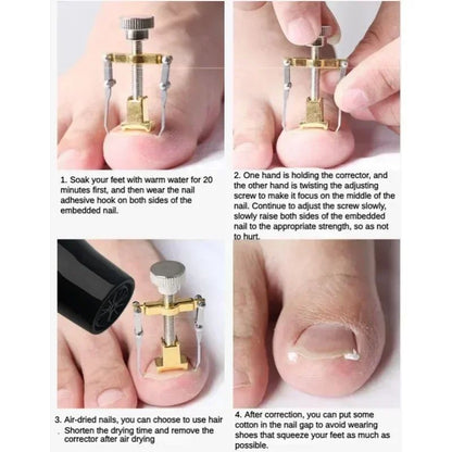 Professional Ingrown Toenail Corrector Kit Stainless Steel Toenail Repair & Relief Tool