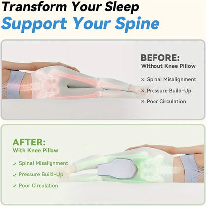 Memory Foam Knee Pillow for Side Sleepers – Between Legs Leg Pillow for Sciatica, Hips & Back Alignment