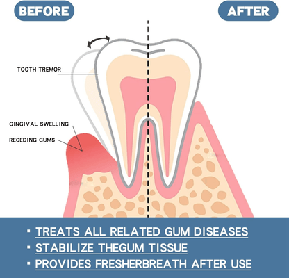 Rapid Repair Gums Serum, Instant Relief for Sensitive Teeth, Cavities & Gum Damage