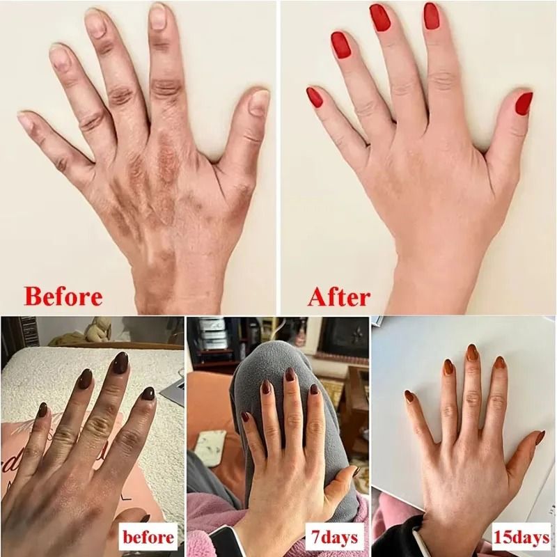 Anti-Wrinkle Coconut Oil Hand Cream – Intensive Anti-Crack & Repair Serum