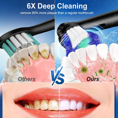 Rechargeable Rotary Electric Toothbrush for Adults – 8 Soft Brush Heads Included
