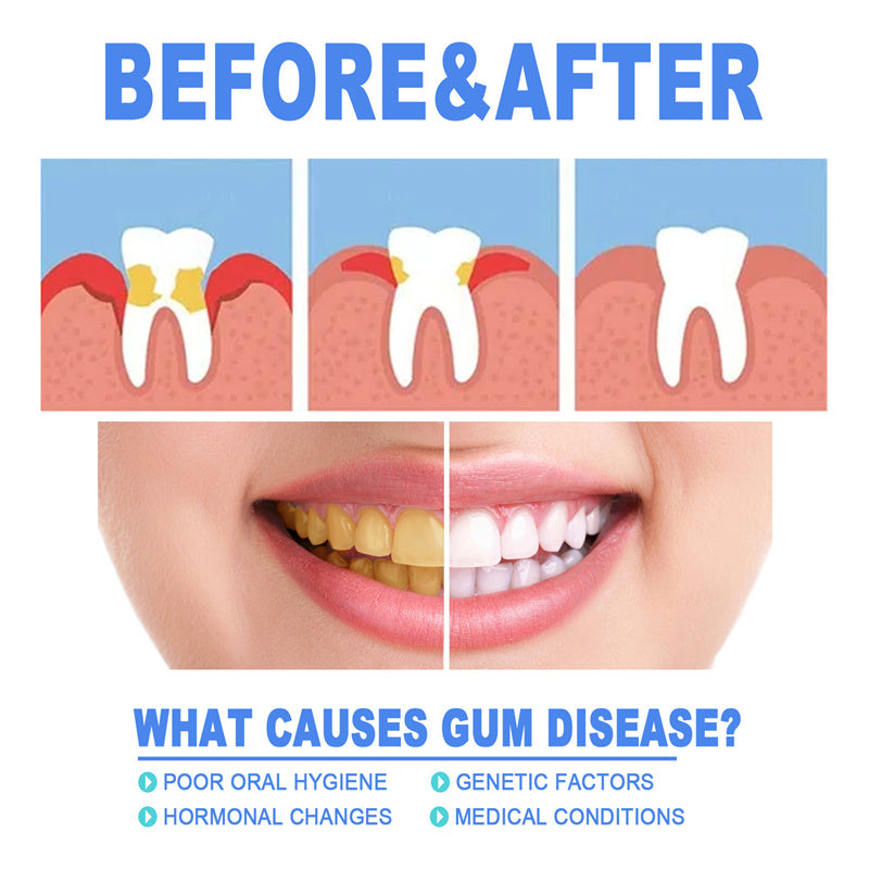 Fast Relief Gum Repair Serum for Sensitive Teeth & Stronger Daily Gum Care
