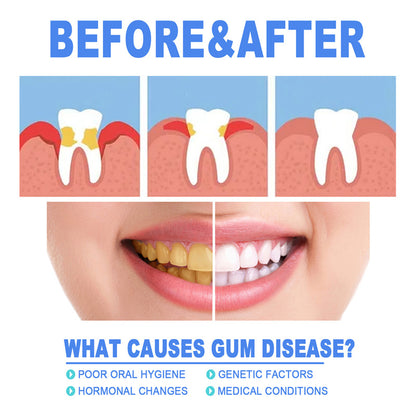 Fast Relief Gum Repair Serum for Sensitive Teeth & Stronger Daily Gum Care