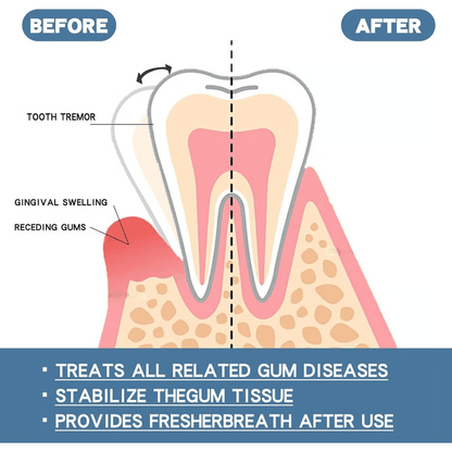 Fast Relief Gum Repair Serum for Sensitive Teeth & Stronger Daily Gum Care