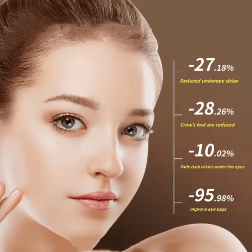 EyeLift Pro EMS Eye Massager Mask for Puffiness and Dark Circles