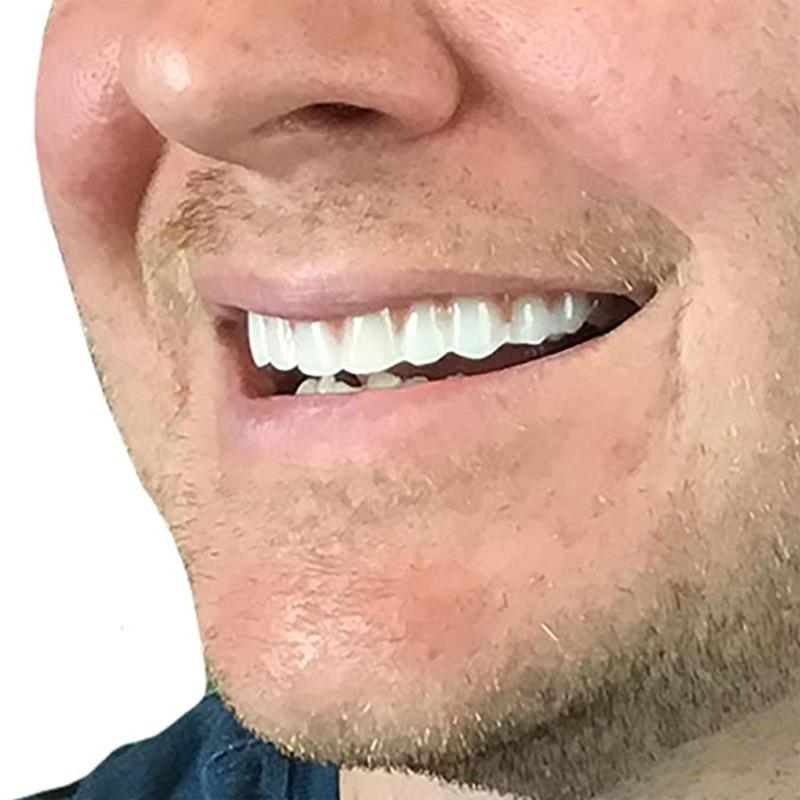 Natural Fit Instant Smile Teeth Cover Temporary Snap On Veneer
