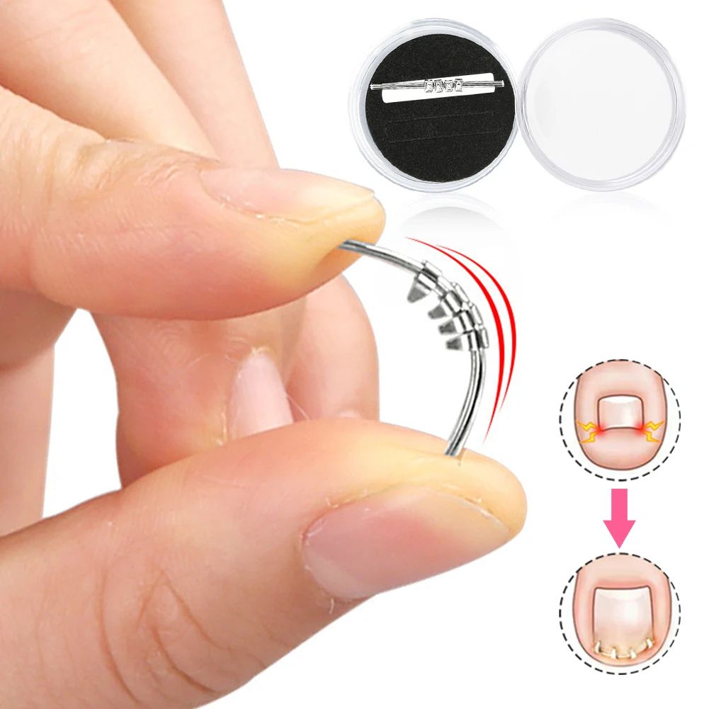 Ingrown Toenail Corrector Tool Precision Nail Lifting Clamp