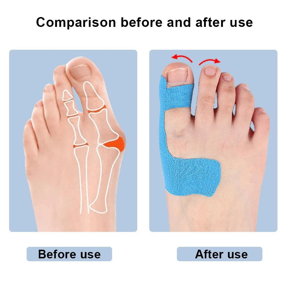Premium Bunion Relief Tape Precut Bunion Corrector Tape for Toe Alignment & Pain Support