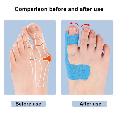 Premium Bunion Relief Tape Precut Bunion Corrector Tape for Toe Alignment & Pain Support