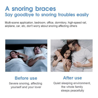 SilentComfort Anti Snoring Mouthpiece for Better Sleep & Teeth Grinding Relief