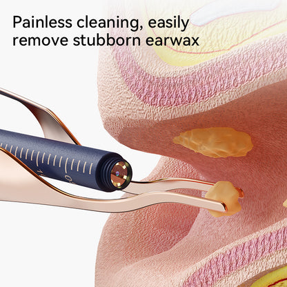 ClearView HD Smart Ear Wax Cleaner Camera for Safe Wireless Ear Cleaning