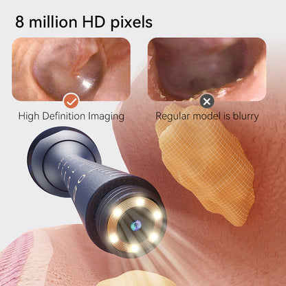 ClearView HD Smart Ear Wax Cleaner Camera for Safe Wireless Ear Cleaning