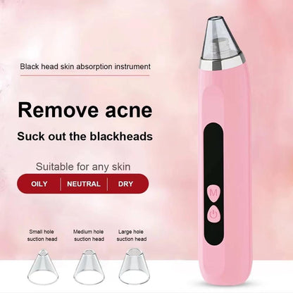 Blackhead Remover Vacuum Deep Pore Cleaner with 3 Suction Levels and 3 Facial Cleaning Heads