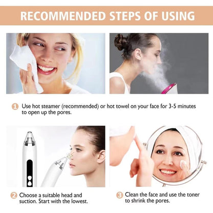 Blackhead Remover Vacuum Deep Pore Cleaner with 3 Suction Levels and 3 Facial Cleaning Heads